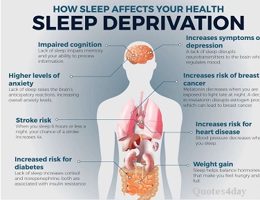 Causes of sleep deprivation